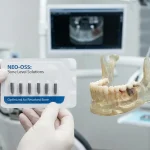 ایمپلنت برای استخوان‌های تحلیل‌رفته؛ معرفی بهترین برندهای ۲۰۲۵ + راهنمای نجات فک