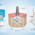 قیمت پودر استخوان و ممبرین برای ایمپلنت