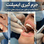 جرم گیری ایمپلنت دندان